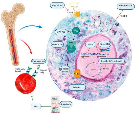 Pediatric Myelodysplastic Syndrome